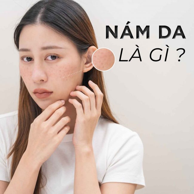 Nám